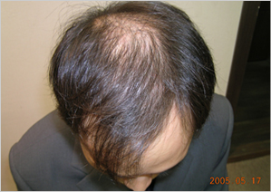 case studies for hair restoration