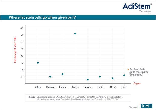 Diagram Fat Stem Cells Treatment