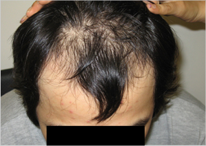 case studies for hair restoration